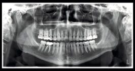 radiologie panoramique
