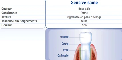 gencive saine